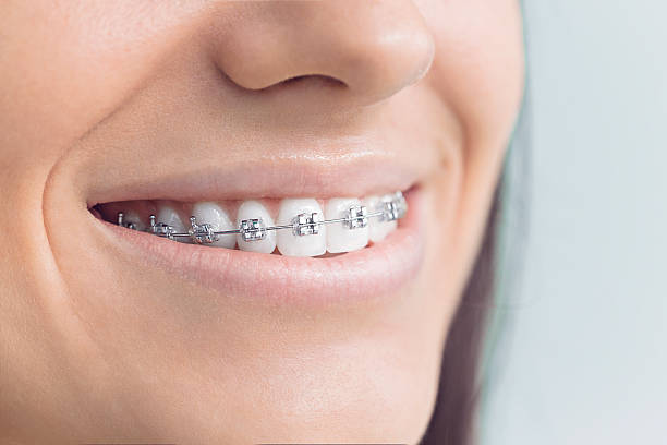 Trusted Pardeeville, WI  Holistic Dental Services Experts